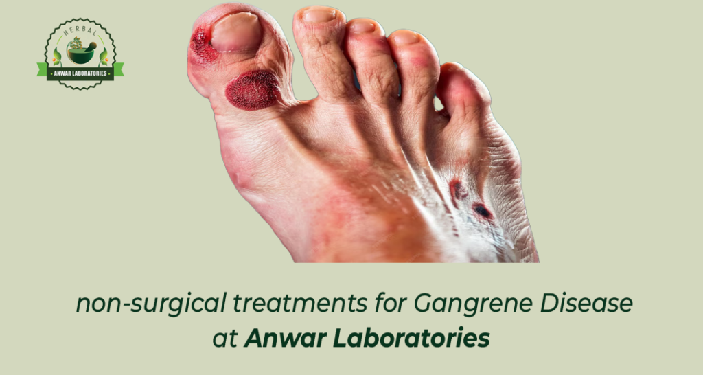 gangrene-treatment